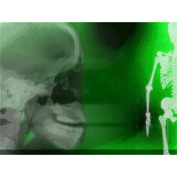 Human X-ray qx